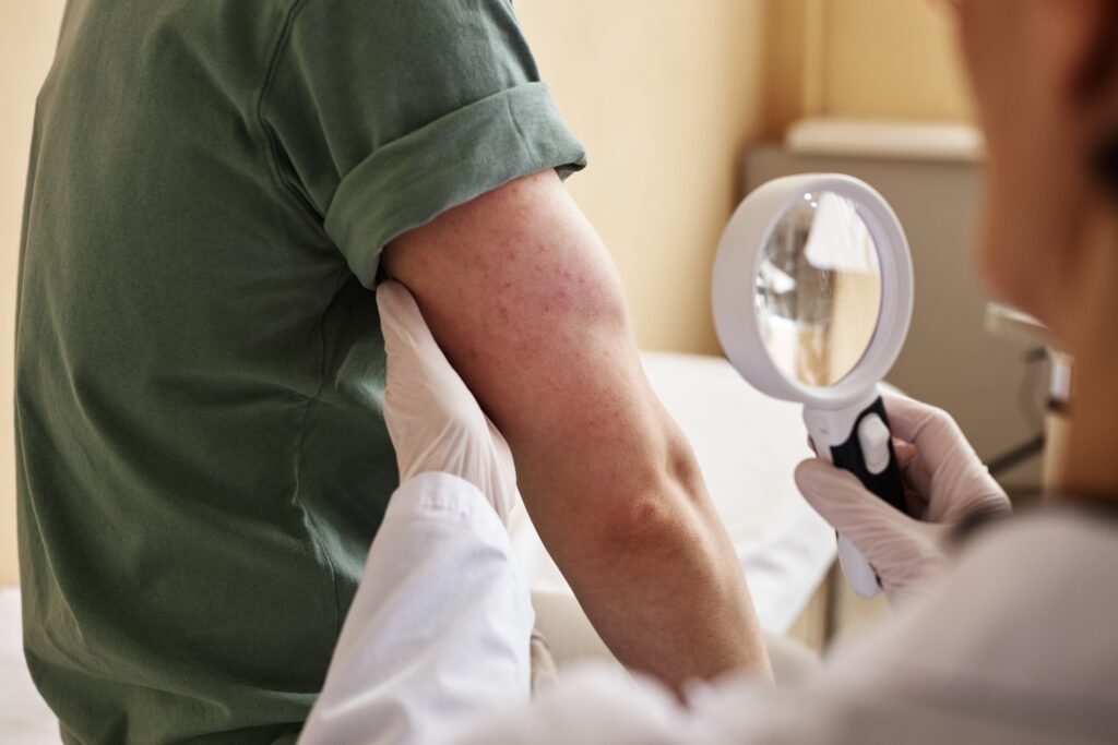 When Is a Rash Serious? Dermatologist Advice on When to Seek Help