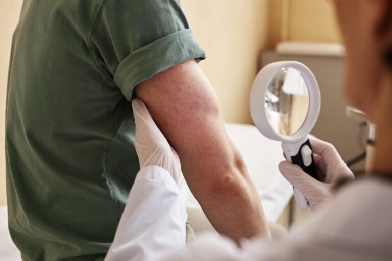 When Is a Rash Serious? Dermatologist Advice on When to Seek Help