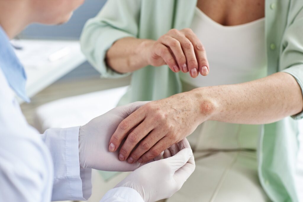 Eczema 101: Triggers, Treatments & Dermatologist-Approved Care Tips