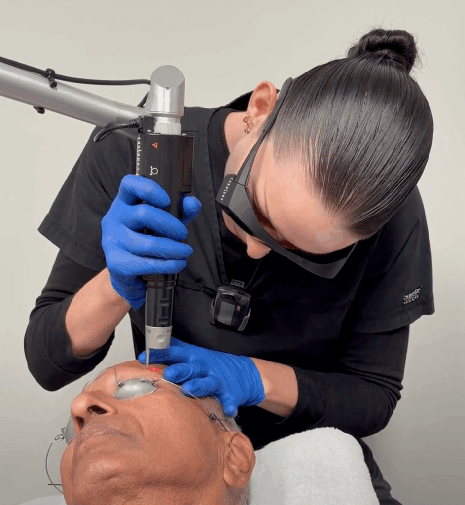 Dr Refresh Picosecond Laser Treatment