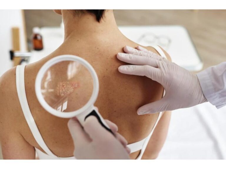 ABC Radio Sydney Interviews Dr Ritu on Skin Cancer for Melanoma March